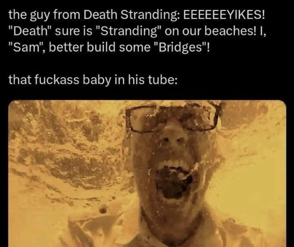 X9rzzeC.png