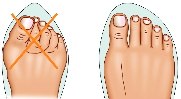 toe-box.png